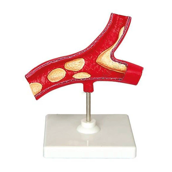 Artery Structure Model